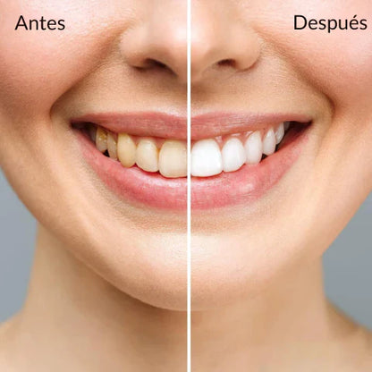 TIRAS 5D DE BLANQUEAMIENTO DENTAL