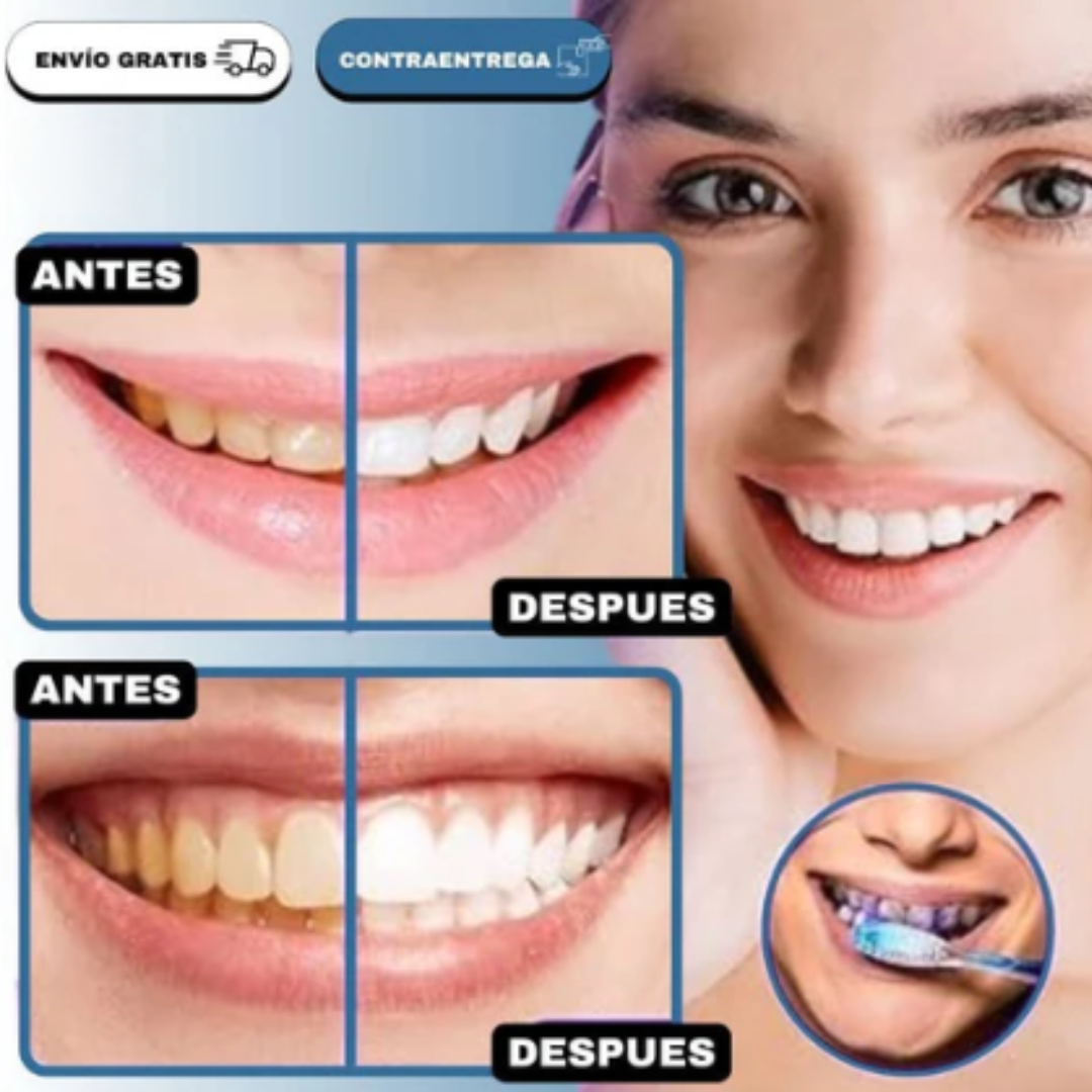 Espuma De Dientes Blanqueadora V34 Hismile