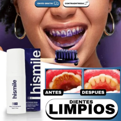 Espuma De Dientes Blanqueadora V34 Hismile